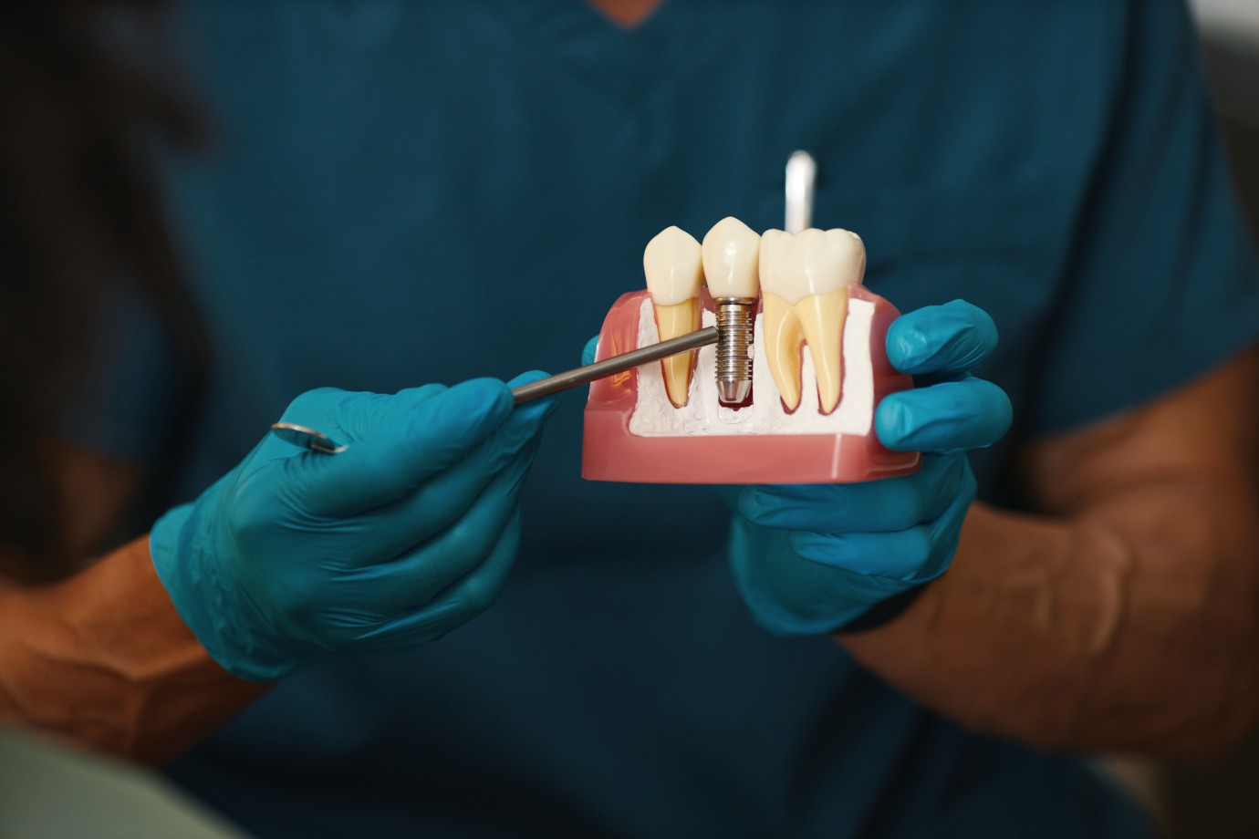 illustrating-dental-implant-procedure-model-1